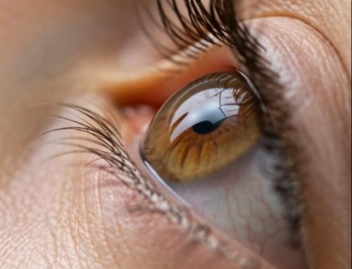 Häufig trockene Augen?